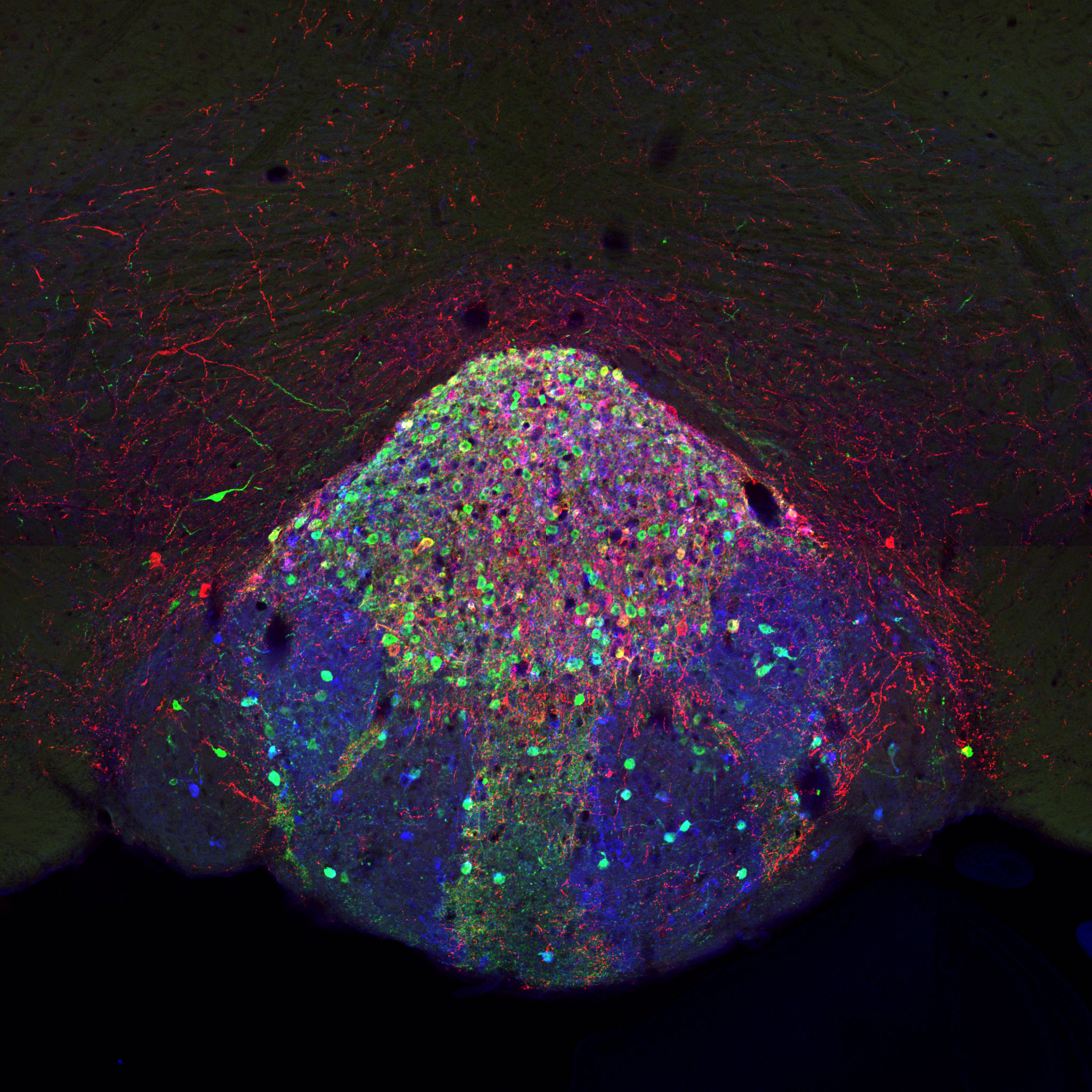 The Ables Lab