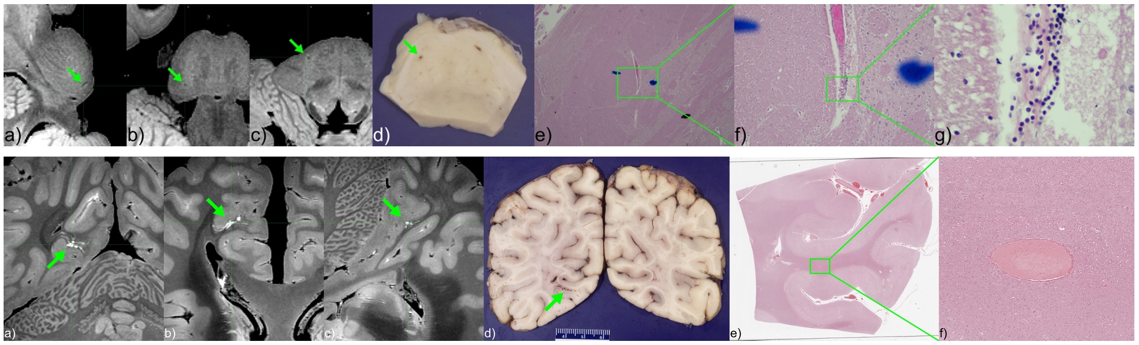 Ex Vivo MRI and Neuropathology