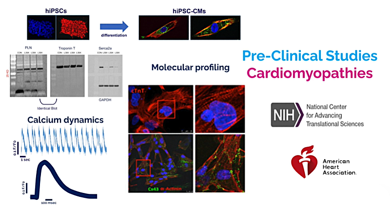 Cardiomyopathy_trivieri lab